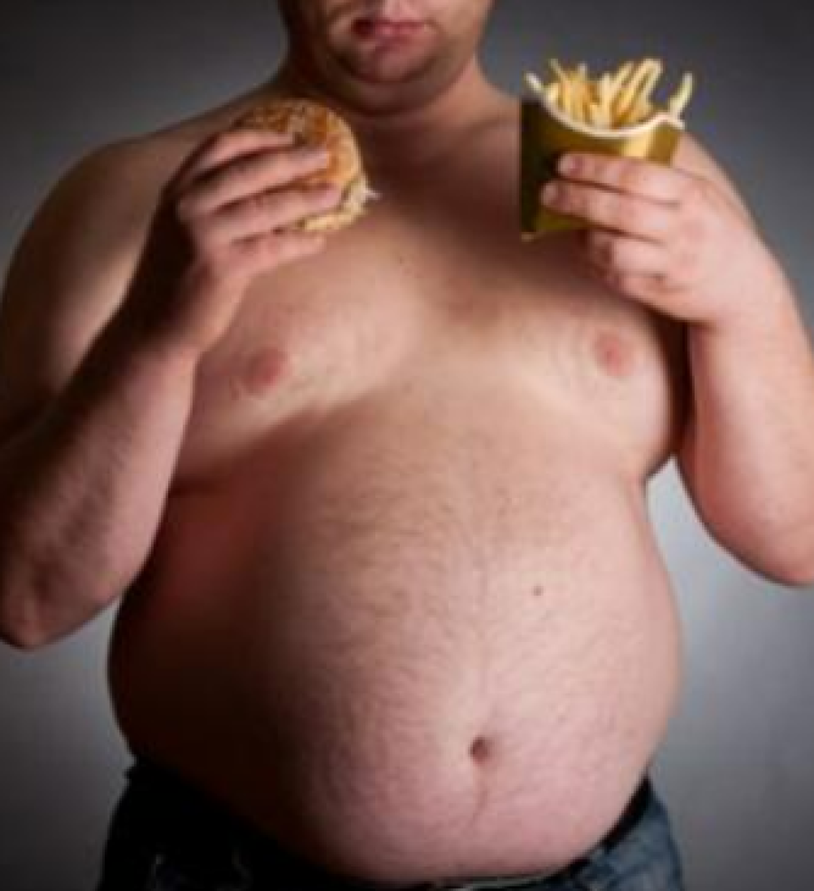 RN é 2º em obesidade adulta no país