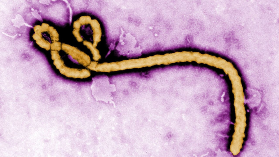 São Paulo descarta segundo caso suspeito de ebola e reforça vigilância epidemiológica